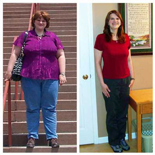 Sharon before after